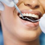 Smile Smart: 5 Expert-Backed Reasons to Prioritize Oral Hygiene Oral Hygiene