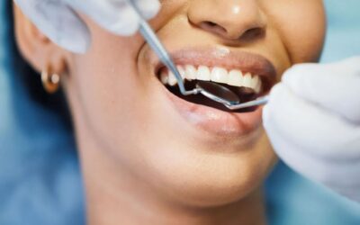 Oral Hygiene