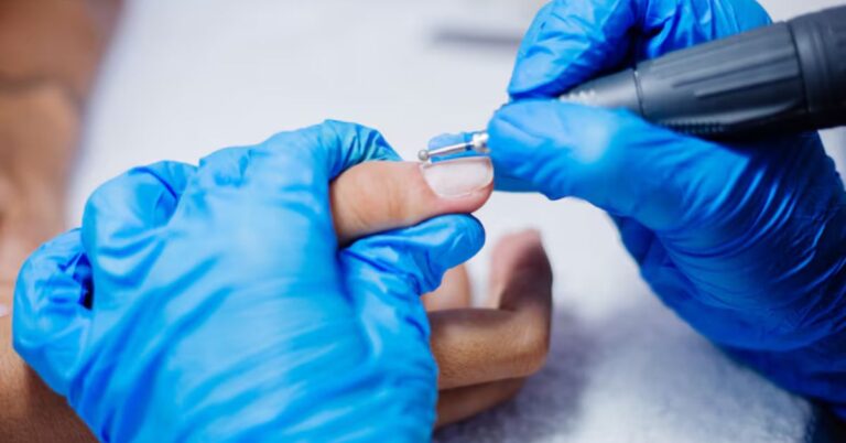 Treatments for Ingrown Toenails